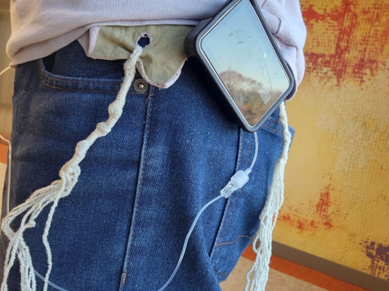 A person wearing jeans with an insulin pump tucked into a pocket, connected to a charger with braided strings.